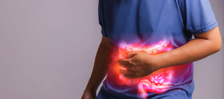 Imagem do post Doença inflamatória intestinal