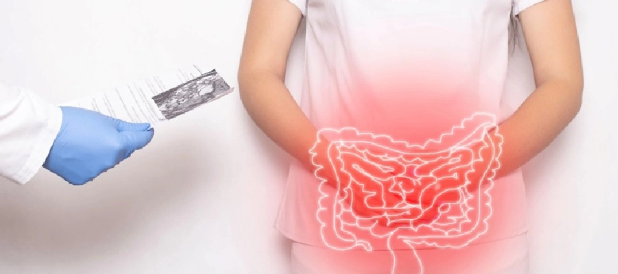 Imagem do post ilustração intestino com dor