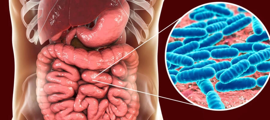 Imagem do post disbiose intestinal