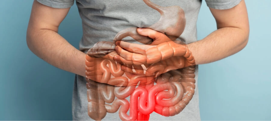 sintomas de virose intestinal​ 