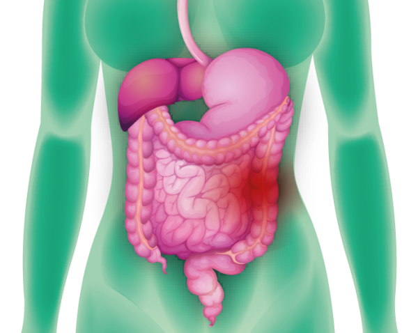 Dor na barriga do lado esquerdo